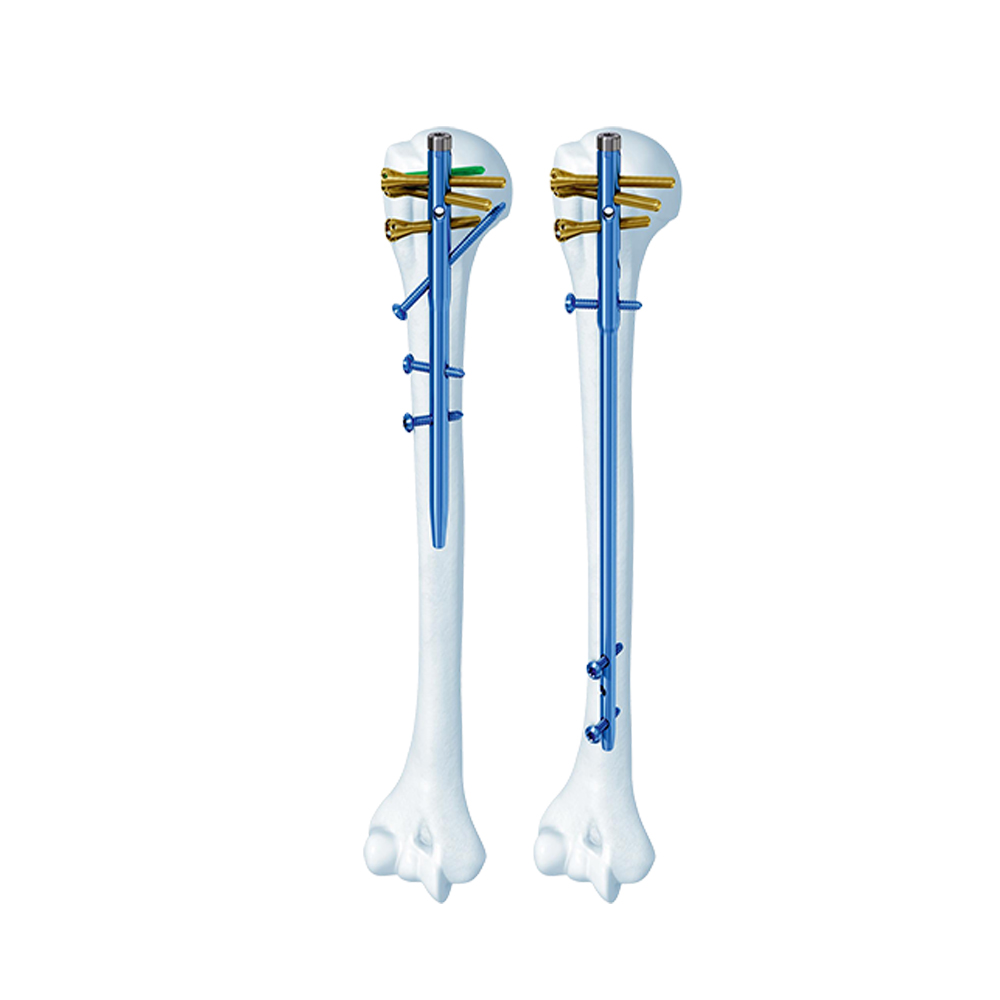 Kuku humerus multi-log