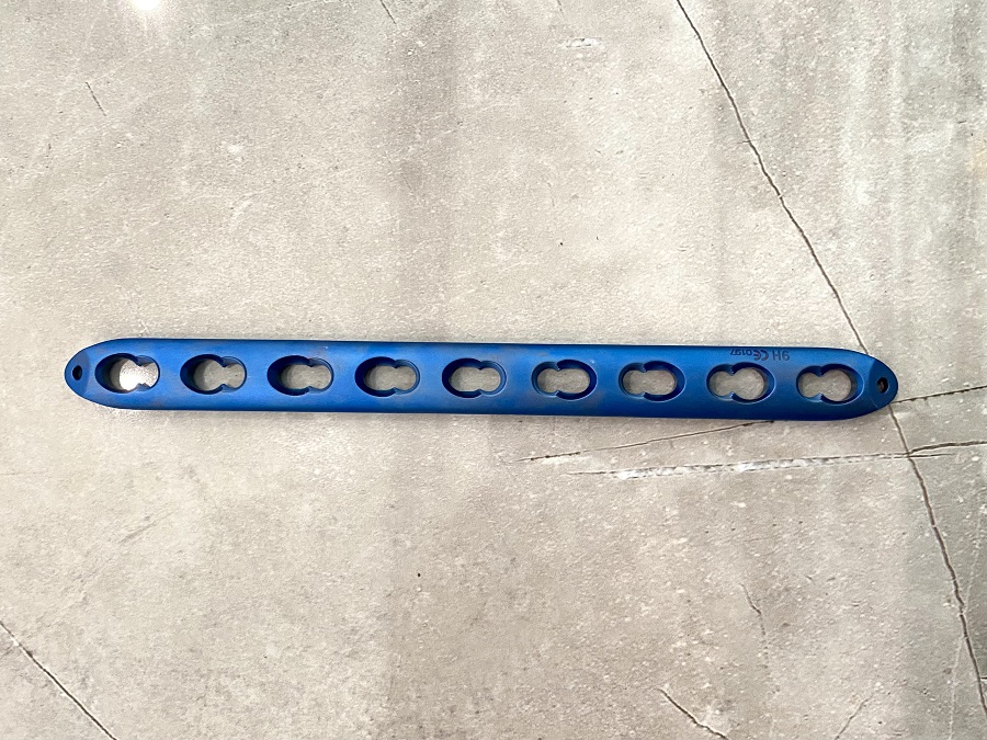 Distal Fibular Locking Plate