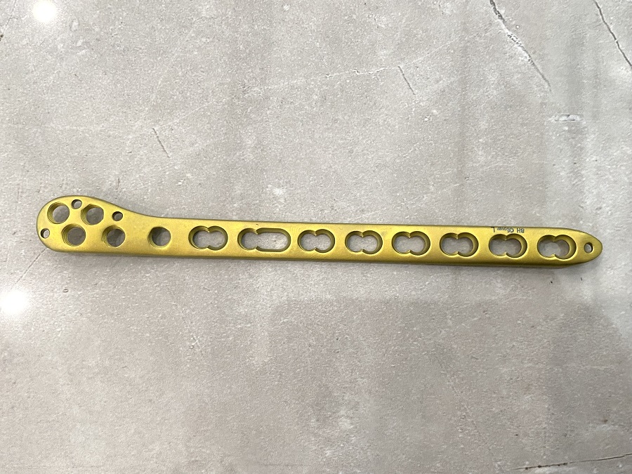 Distal Fibular Locking Plate