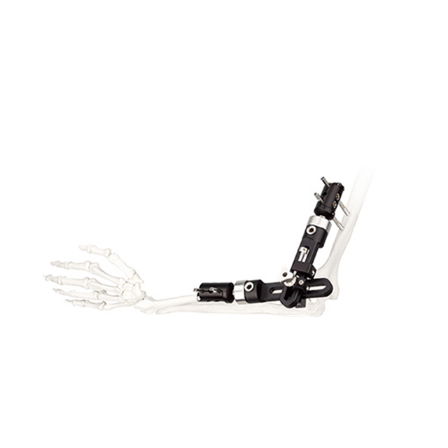 Elbow Fragment External Fixator