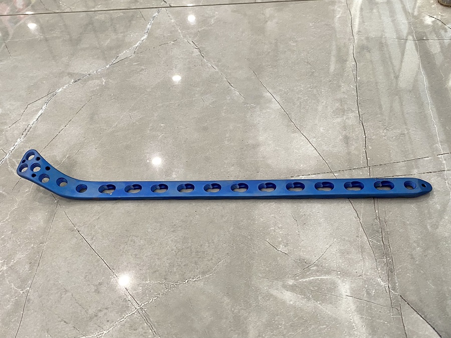 Lateral Tibial Head Buttress Locking Plate