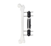 Dynamic Axial Straight Type External Fixator