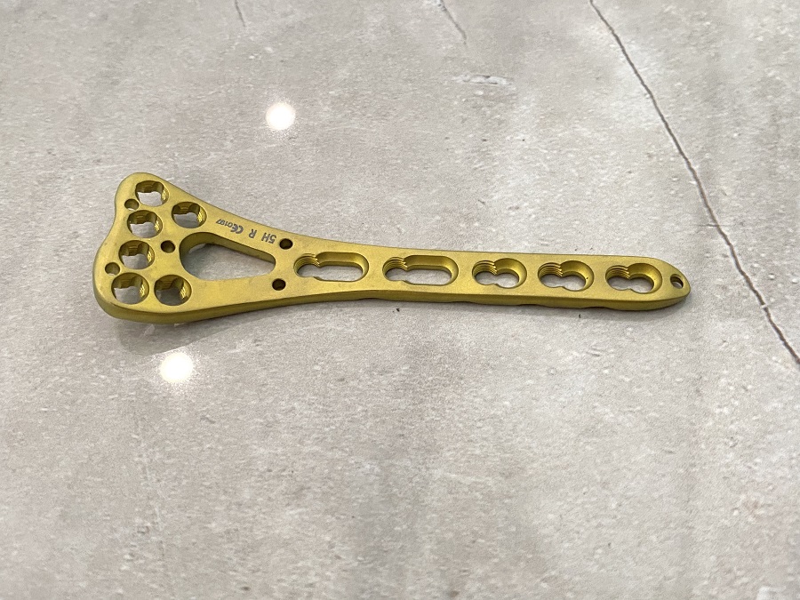 VA Distal Radius Locking Plate