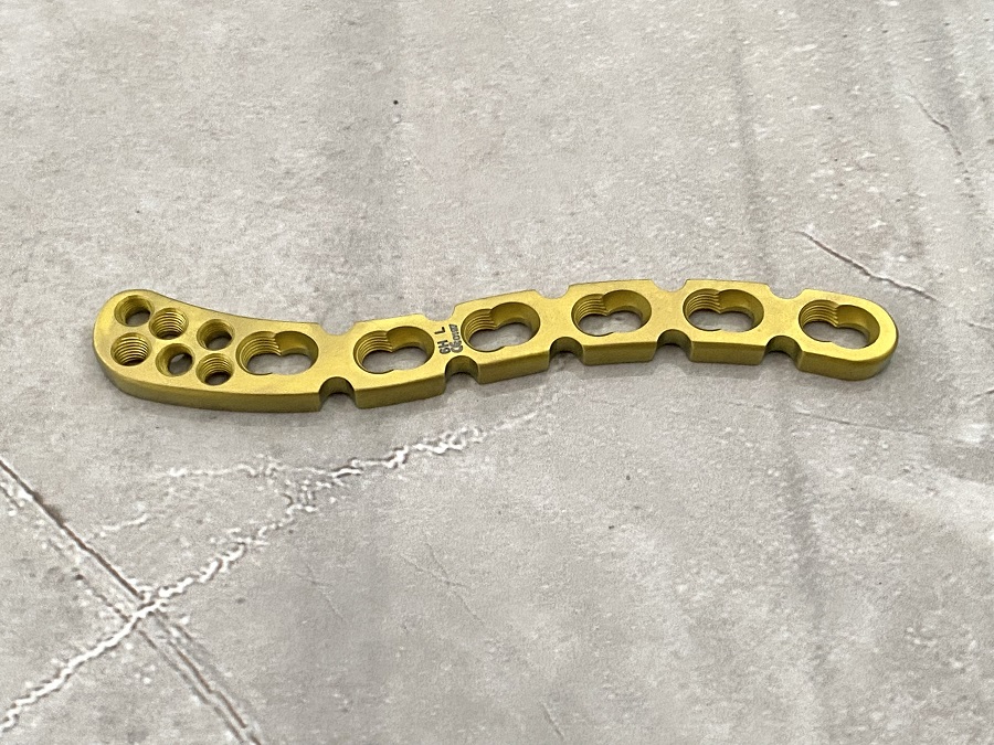 Distal Clavicular Locking Plate
