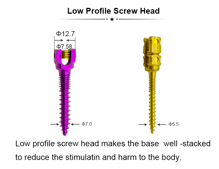 5.5 Details of spinal nails