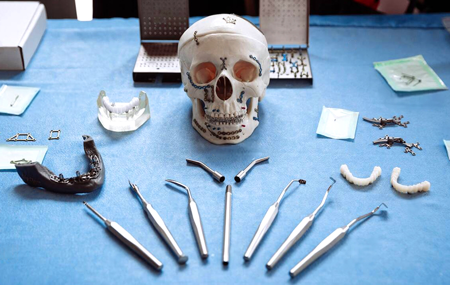 maxillofacial plates