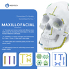 Maxillofacial Plate 1.5MM Self-drilling Screw