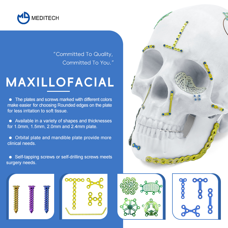 Maxillofacial Plate 1.5MM Self-drilling Screw
