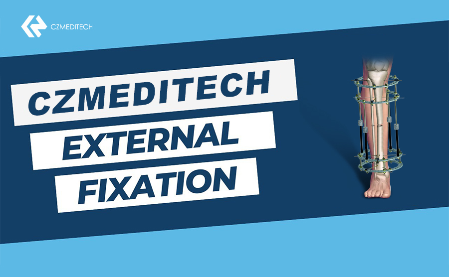 CZMEDITECH External Fixation Device
