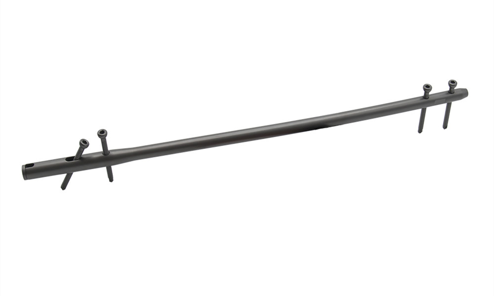 Femoral Intramedullary Nail: A Promising Solution for Femoral Fractures