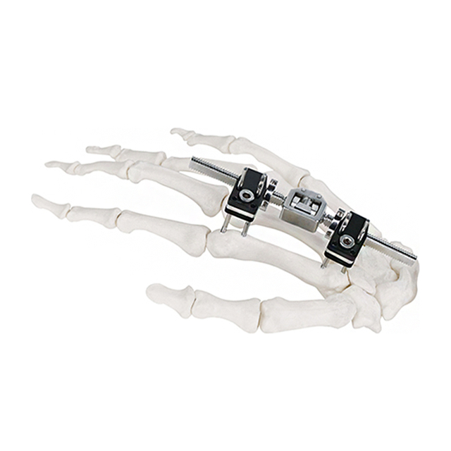 Fixator Eksternal Fragmen Mini - Ketik A