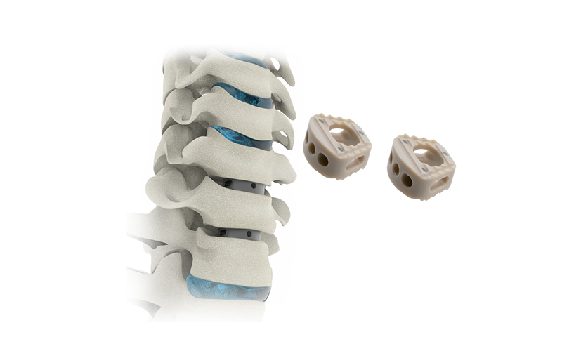 Cervical-peek-Cage-II