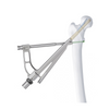 FNS (Femoral Neck System)