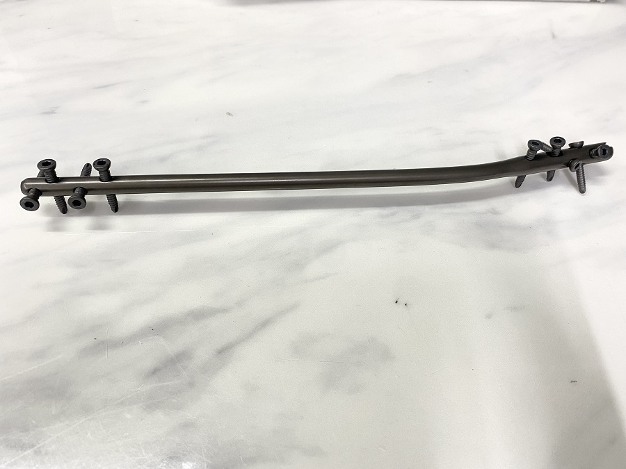 Expert Tibia Nail