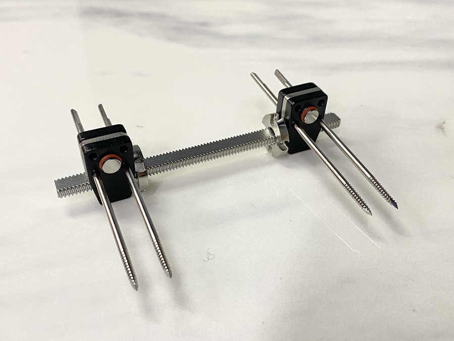 Mini Fragment External Fixator