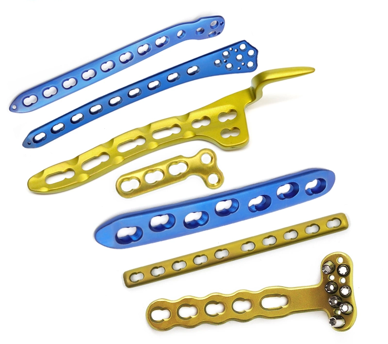 Locking Plate: Enhancing Fracture Fixation with Advanced Technology