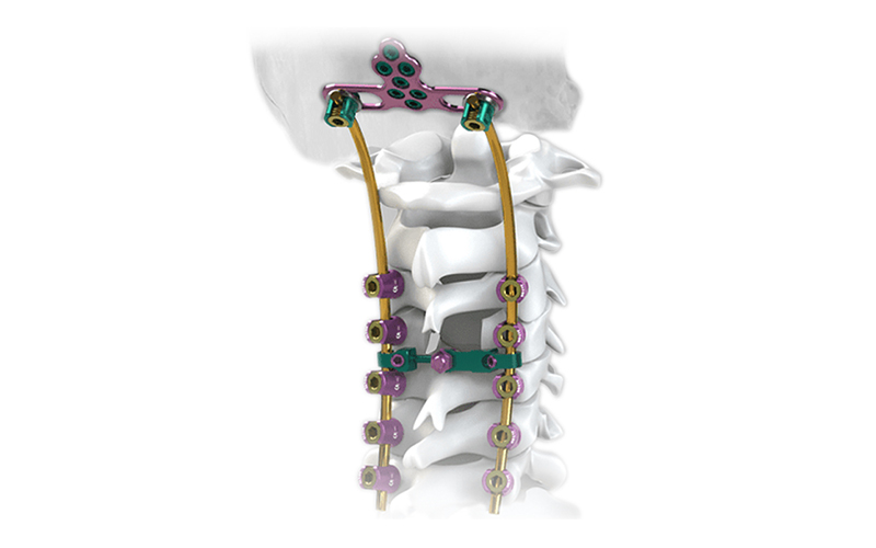 Sistem posterior-Servical-screw