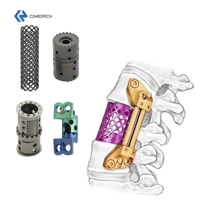 Titanium Mesh Cage