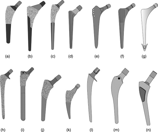Types of femoral stem Types of femoral stem