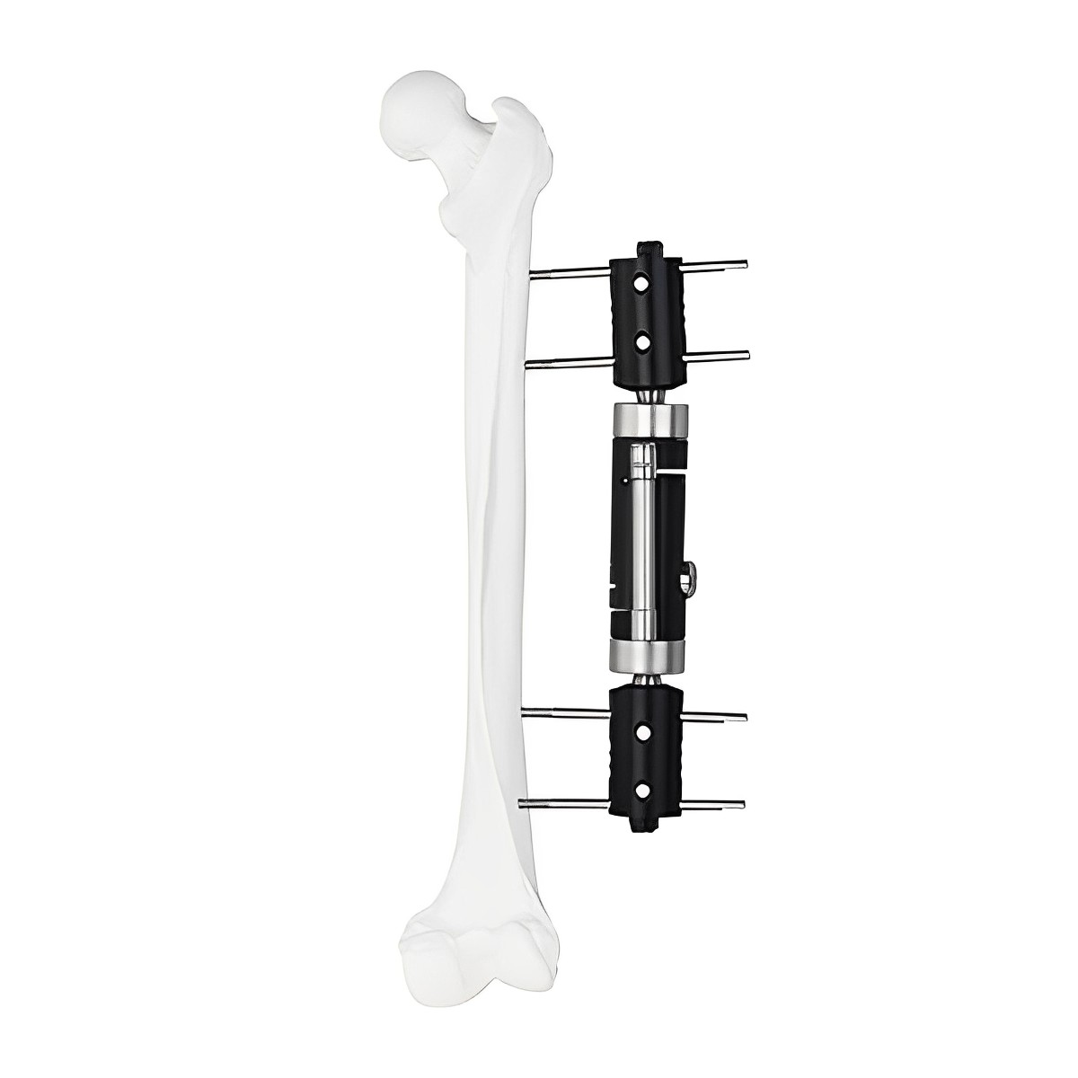 Fixator Multiaxial Dinamis