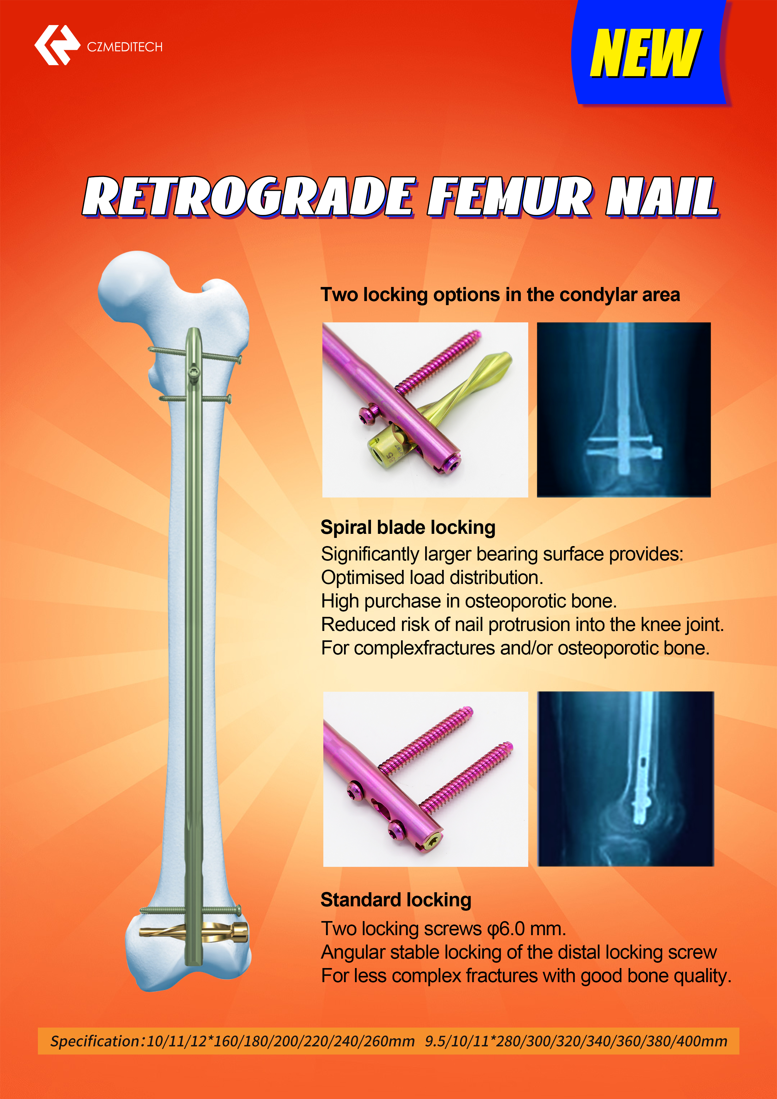 DFN Distal Femur Intramedullary Nail 