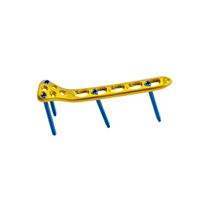 Proximal Radius Locking Plate