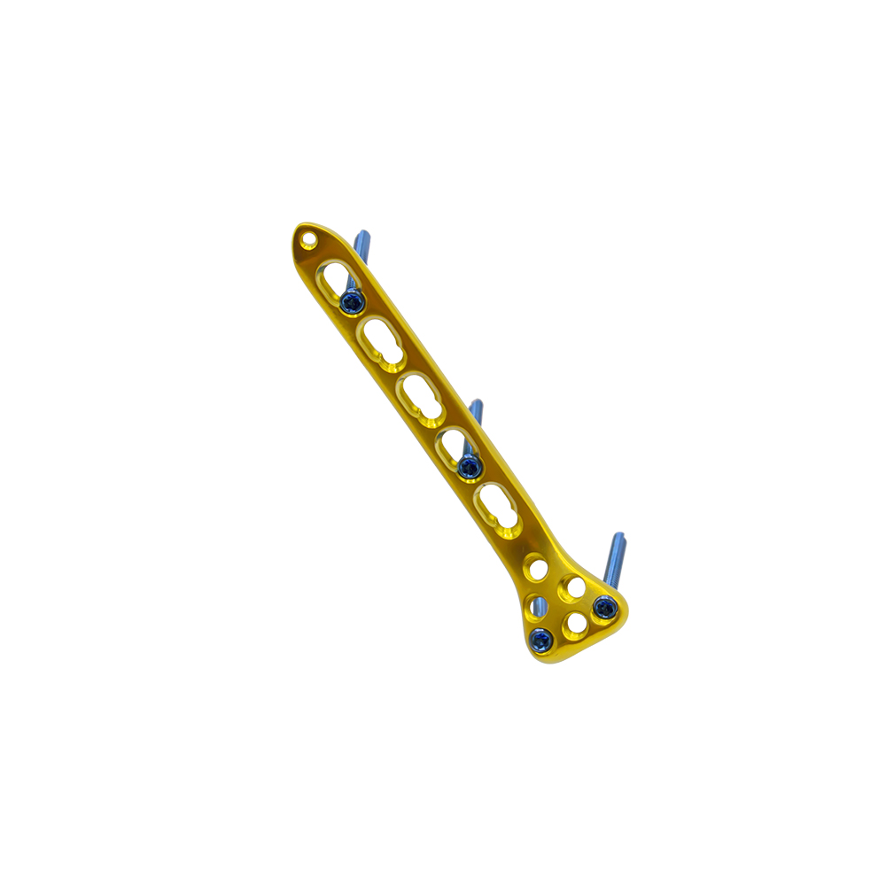 Proximal Radius Locking Plate