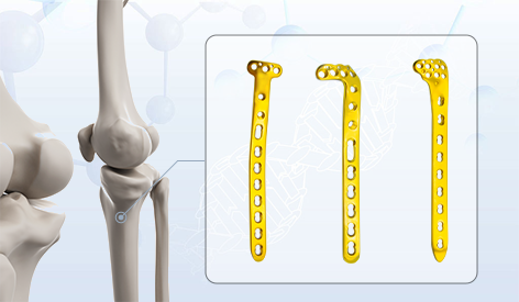 Sinergi klinis dan komersial pelat pengunci lateral tibial proksimal