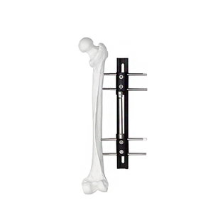 Bone Lengthening External Fixator - Typ A
