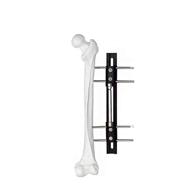 Bone Lengthening External Fixator - Typ A