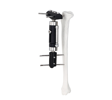 Dynamic Axial Proximal Femoral Fragment External Fixator
