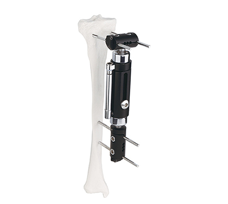Dynamic Axial T-Shape Type External Fixator