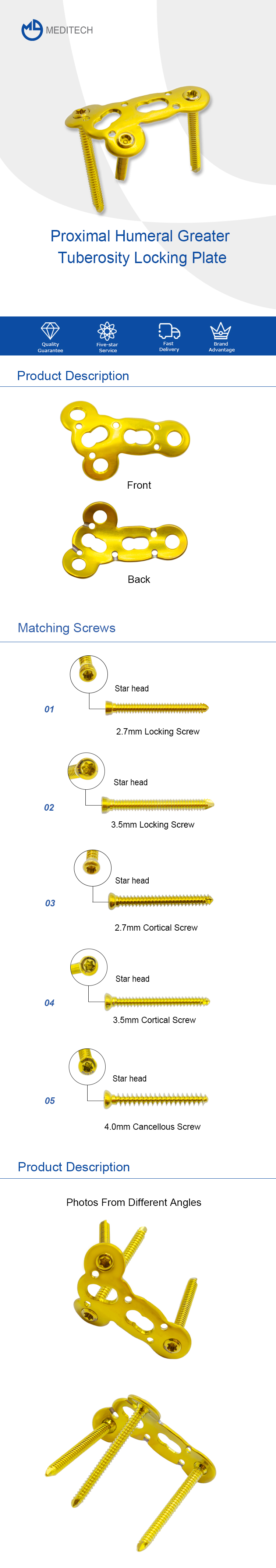 Proximal Humeral Greater Tuberosity Locking Plate 