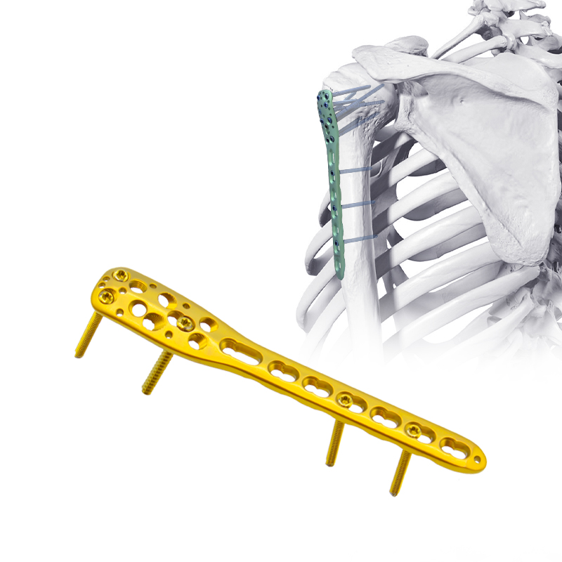 Piring pengunci humerus