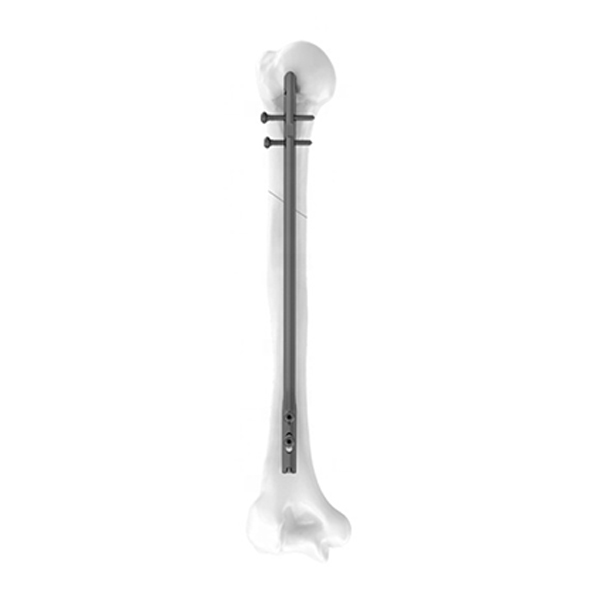 Kuku humerus