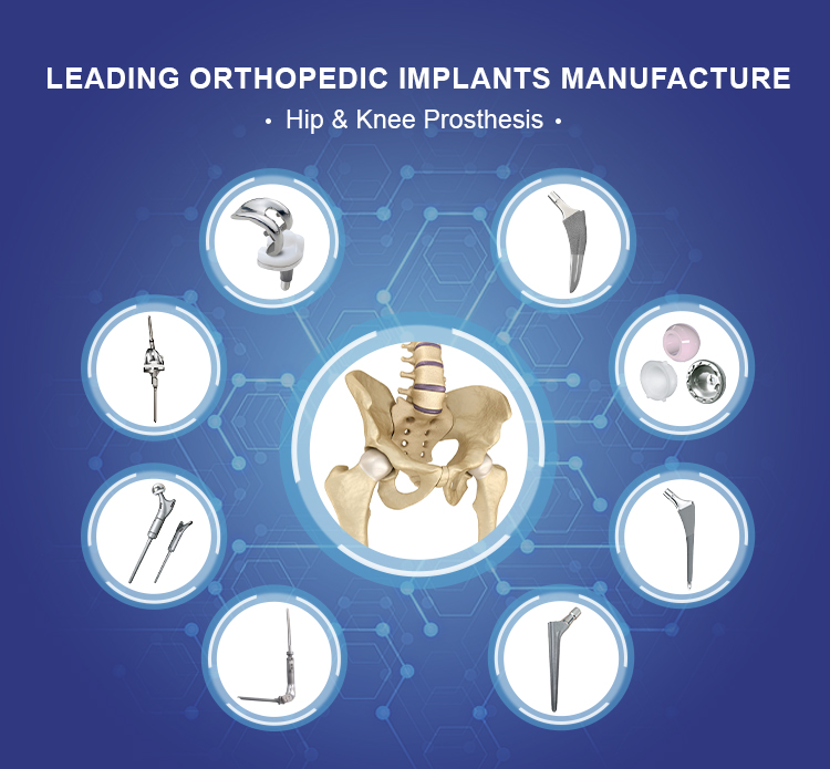 Prosthesis lutut