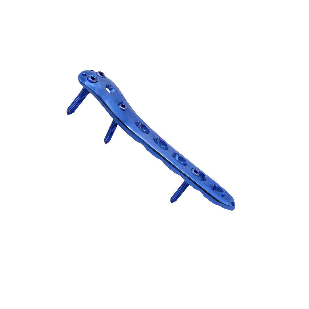 Proximal Femoral Locking Plate-I