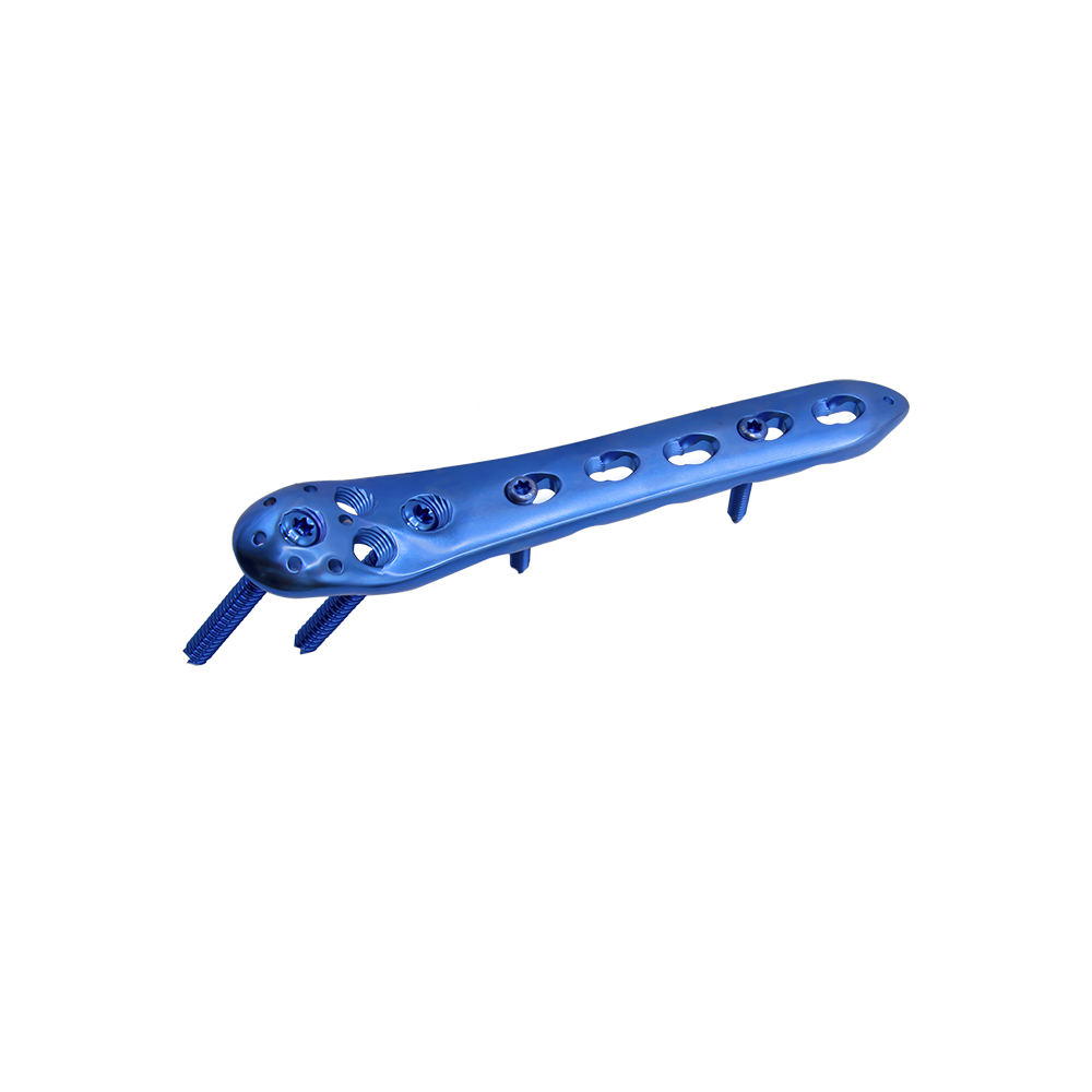 Proximal Femoral Locking Plate-II