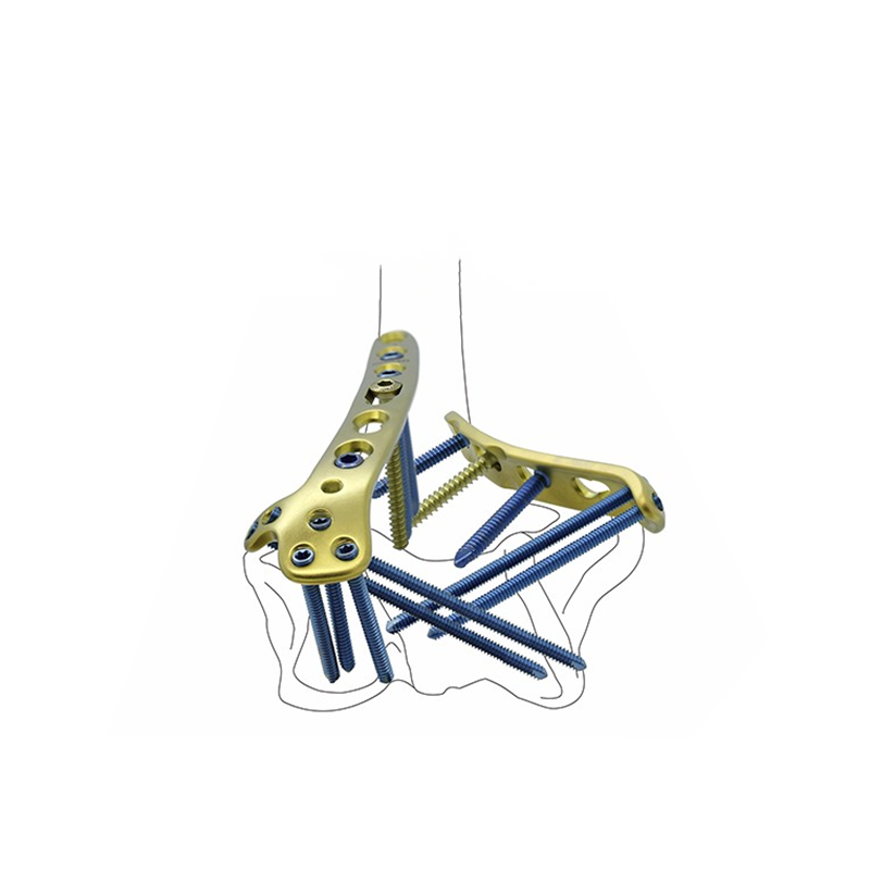Distal Medial Humeral Locking Plate