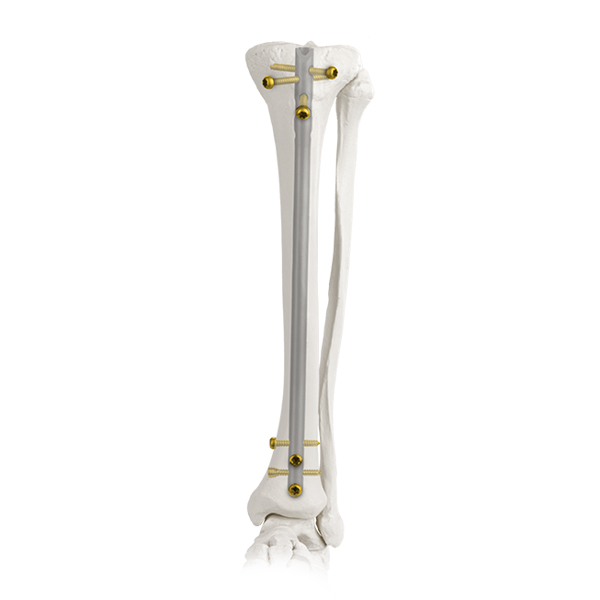 Kuku tibial