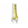 Proximal Lateral Tibial Locking Plate-I