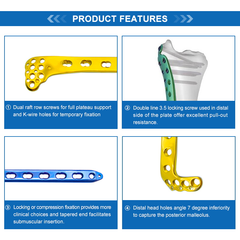 Proximal Medial Tibial Locking Plate