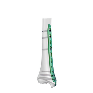 Distal Medial Tibial Locking Plate-I