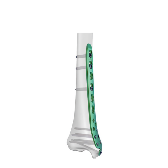 Pelat pengunci tibialis medial distal-I