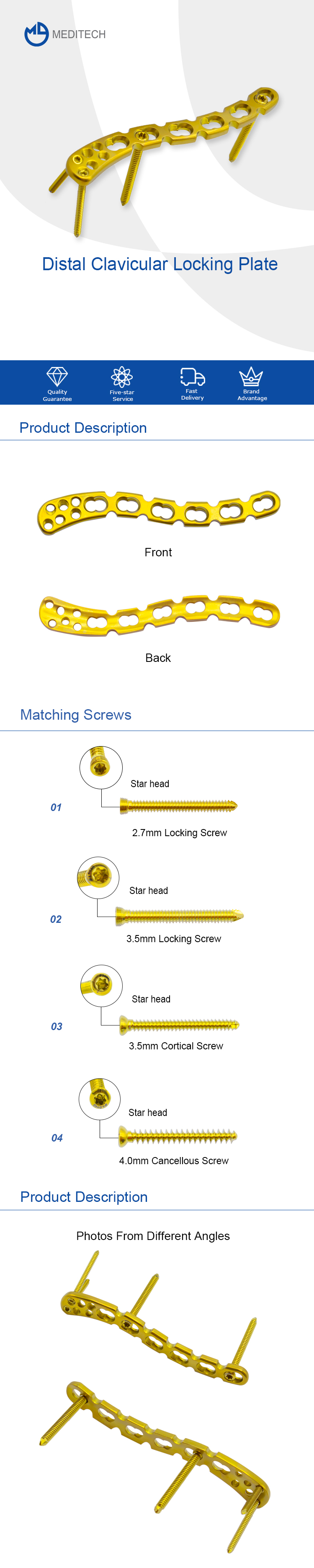 Distal Clavicular Locking Plate
