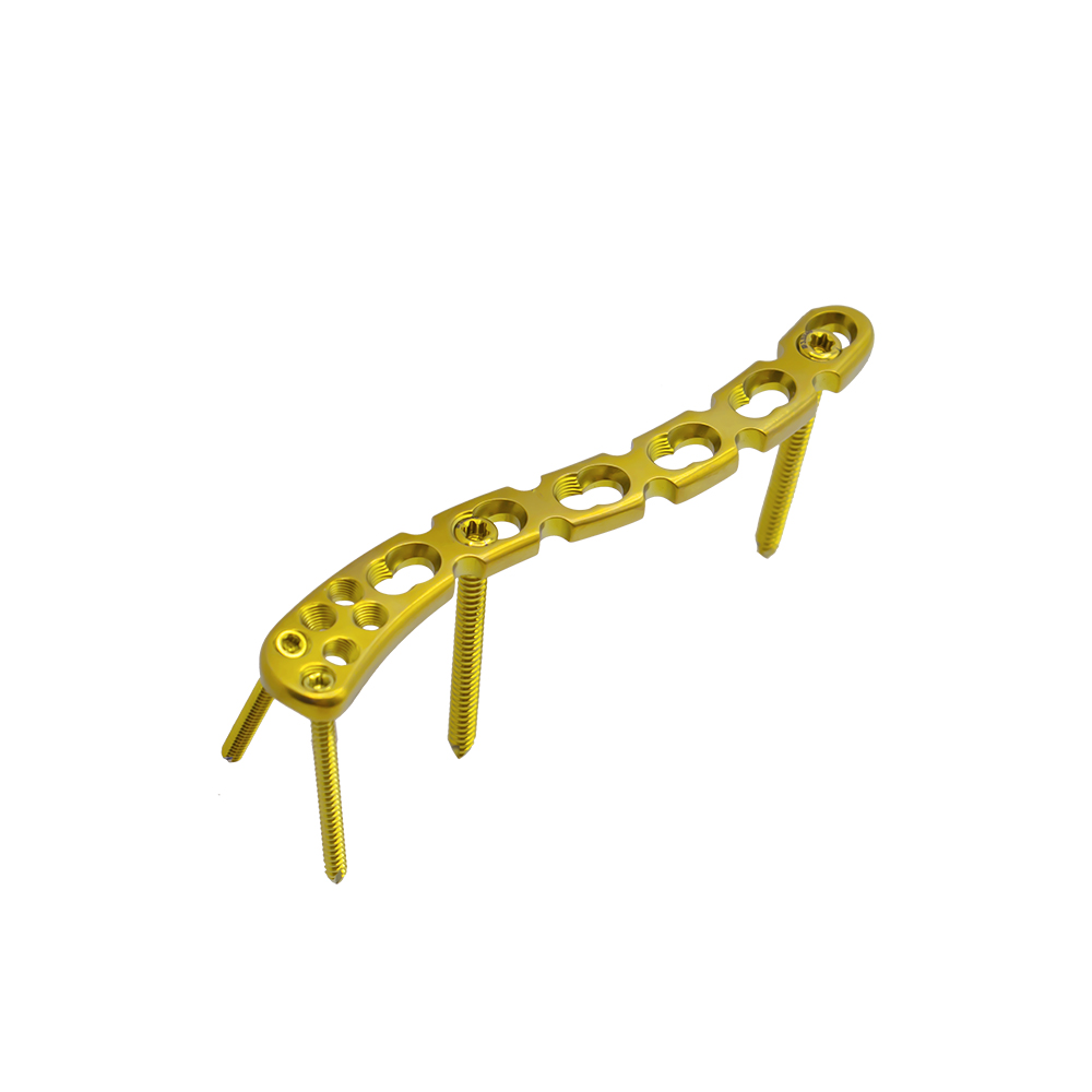 Distal Clavicular Locking Plate