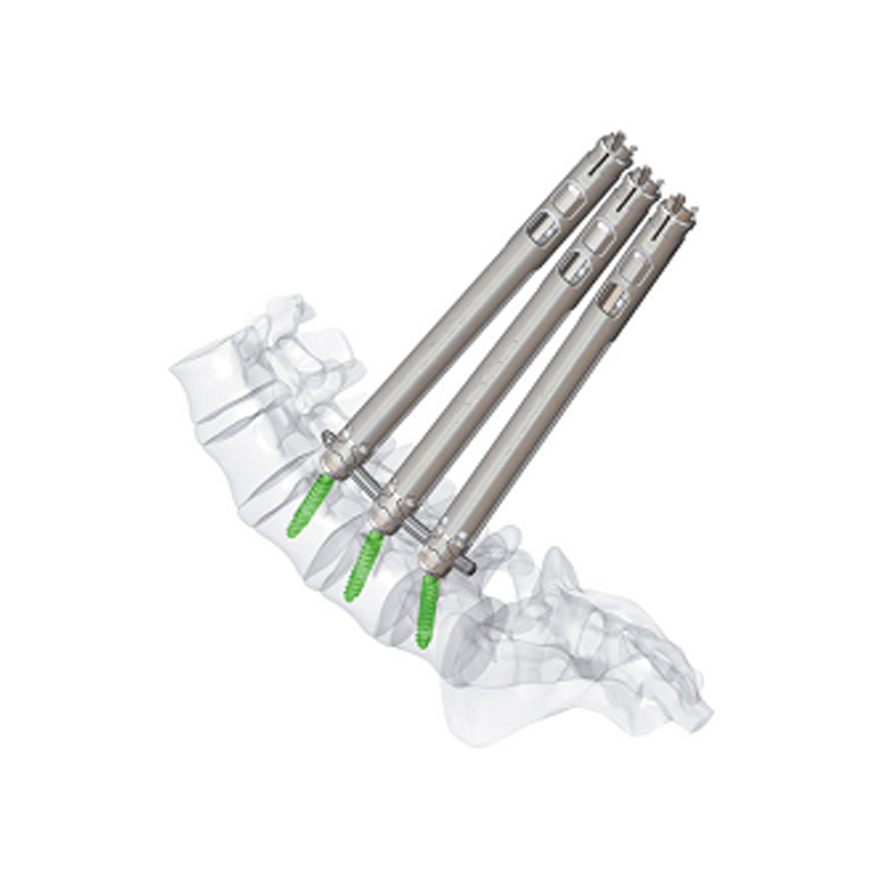 5.5 Minimally Invasive Pedical Screw