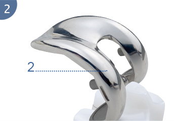 Prosthesis lutut