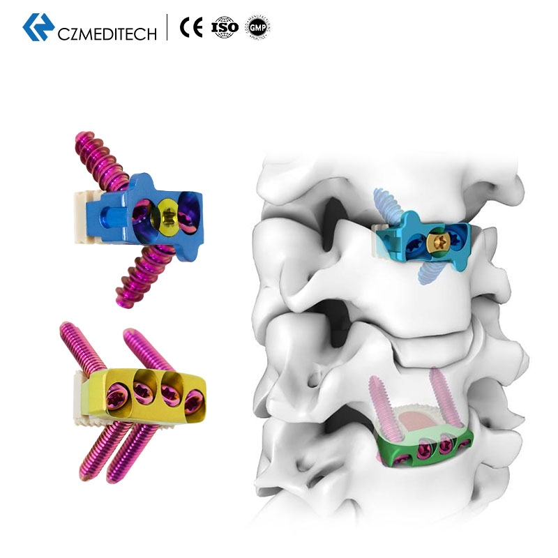 Cervical Peek Cage（2 or 4 Locking Screws）