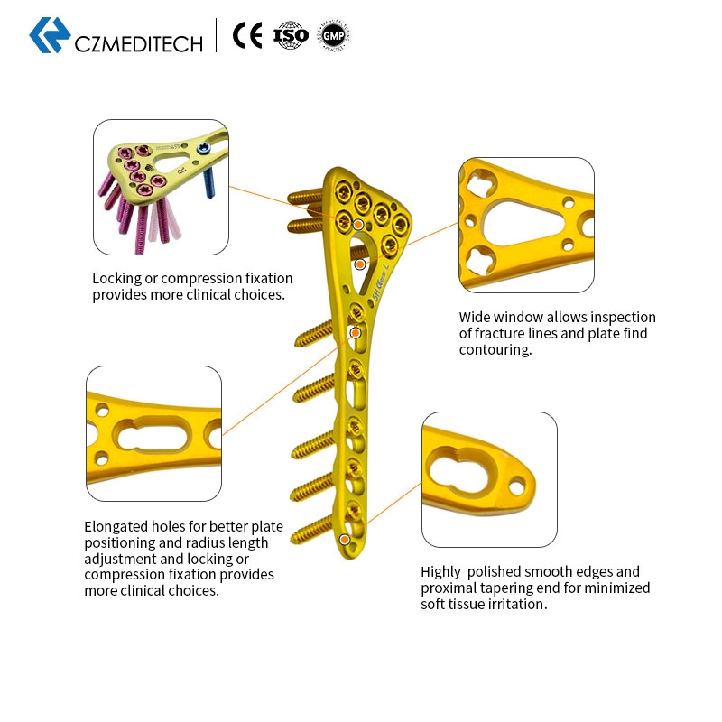 LOCKING PLATE OF ULNA AND RADIUS